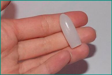 Supozitoare pentru tratamentul cistitei la femei și bărbați